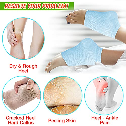 Nado Care 4 Pairs Heels Moisturizing Socks for Dry Cracked Heels Repair - Moisturizing Gel Heel Sleeves Open Toe Comfy Socks Day Night - Pink  Blue  Grey and Black - Image 3